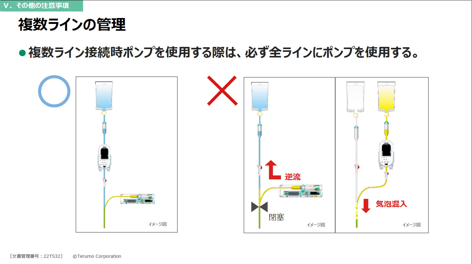 テルフュージョン輸液ポンプ28型 | 医療機器 | テルモメディカルナビ