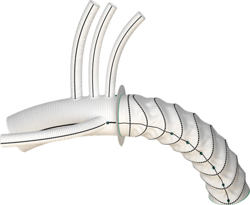 Thoraflex Hybridメイン画像