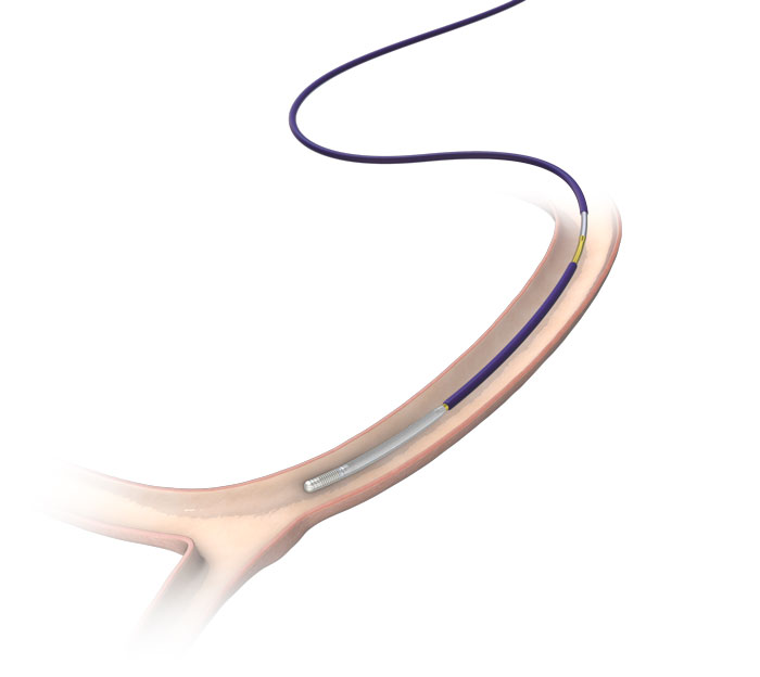 Runthrough NS | 医療機器 | テルモメディカルナビ