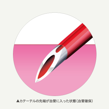 シュアシールドサーフローII / シュアシールドサーフローII H