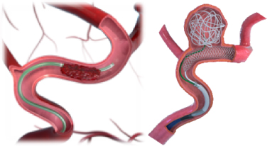 HeadwayPlus | 医療機器 | テルモメディカルナビ