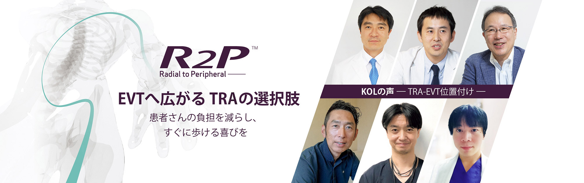 EVIに広がるTRIの選択肢:患者さんの負担を減らし、すぐに歩ける喜びを