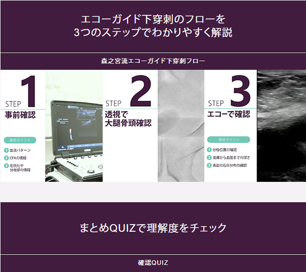 エコーガイド下穿刺のフローを 3つのステップでわかりやすく解説