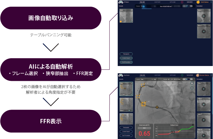 血管造影からFFR解析までのフロー図