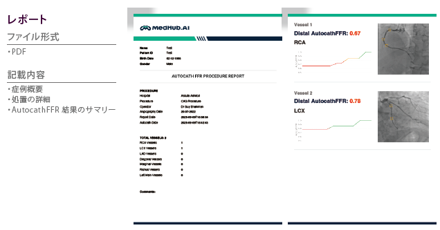 レポートイメージ