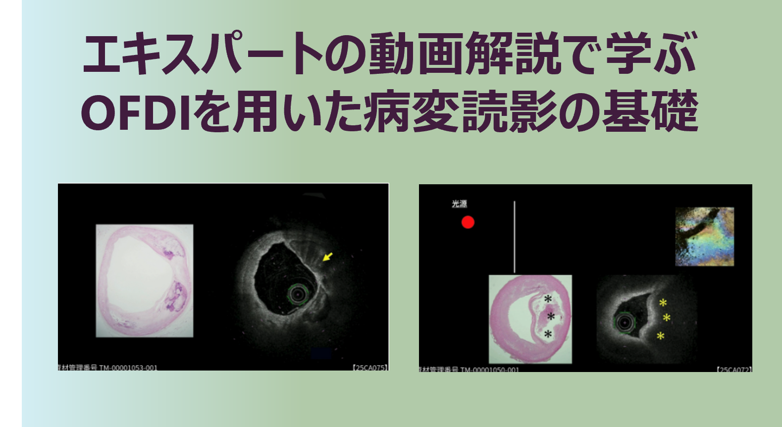 コンテンツタイトル