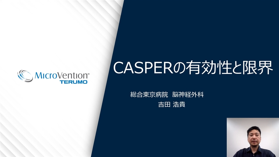 CASPER Rxの有効性と限界