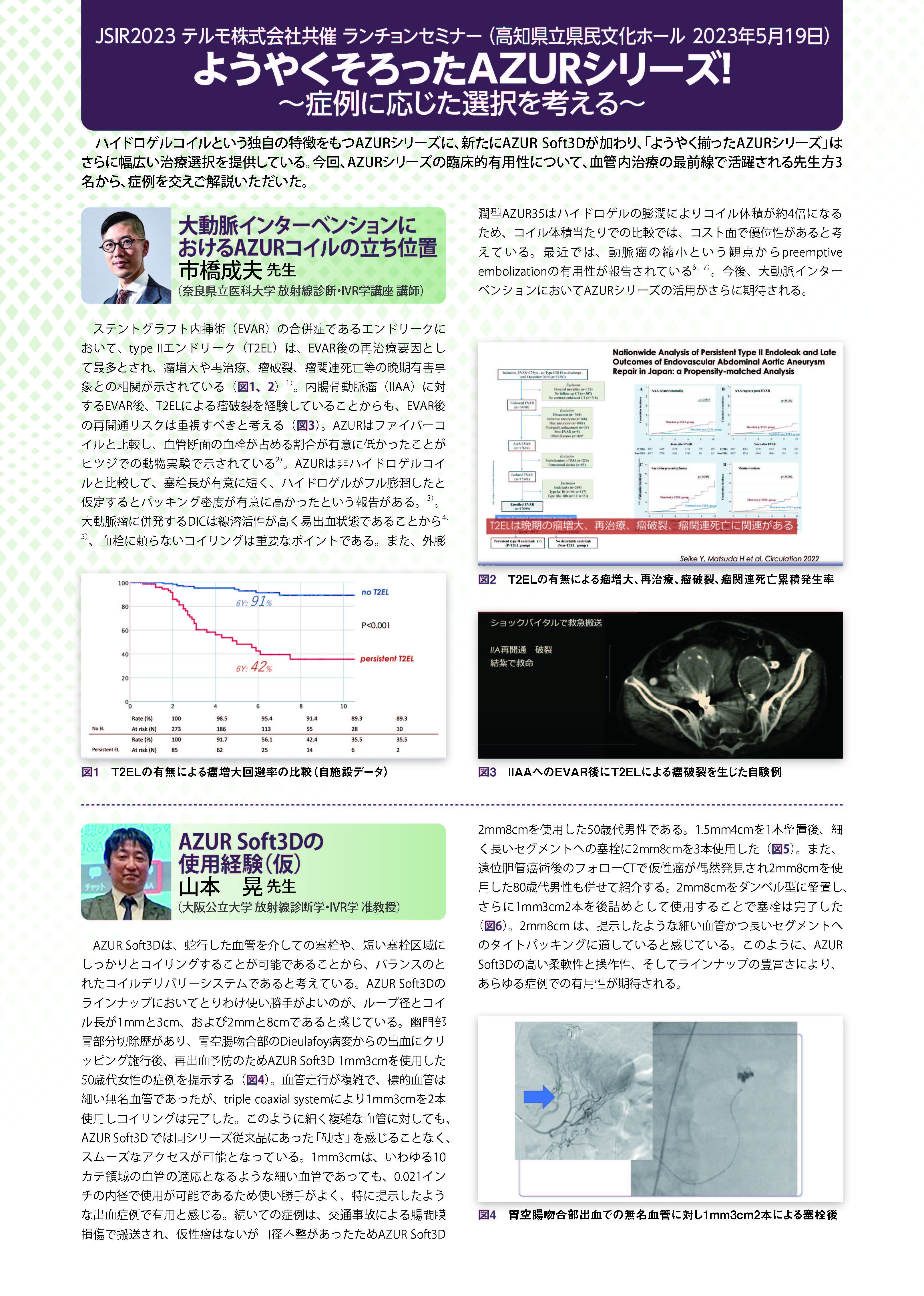 手技情報・導入事例 | AZUR CX18 / CX35 | 医療機器 | テルモ