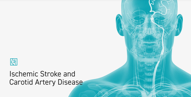 Ischemic Stroke and Carotid Artery Disease（虚血性脳卒中と頸動脈疾患）バナー