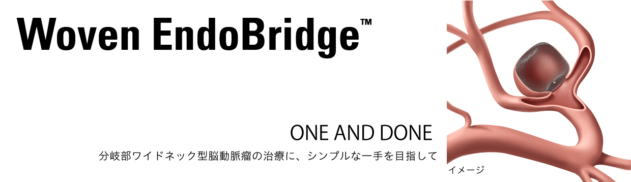 Woven EndoBridgeバナー